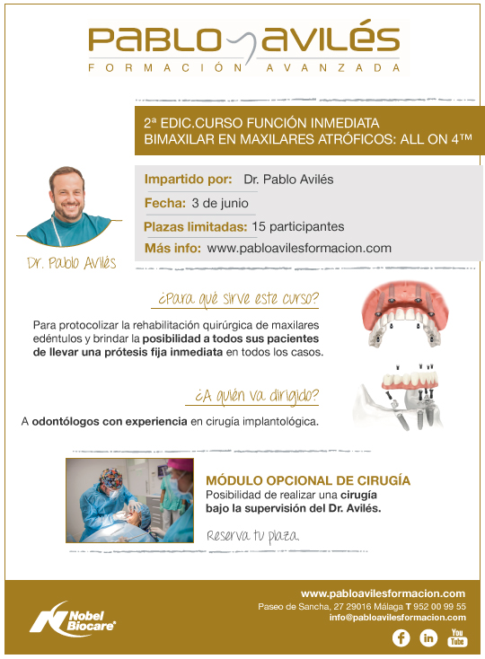 Curso Función Inmediata Bimaxilar en Maxilares Atróficos: All on 4™